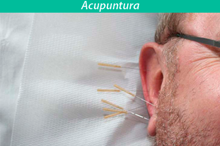 ACUPUNTURA.ESCOLA.CORPO.E.MENTE